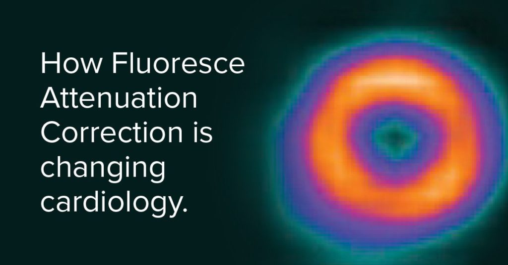 How Fluoresce Attenuation Correction is changing cardiology