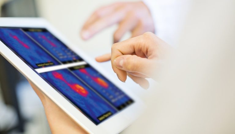 What Cardiologists Need to Know About Cardiac Amyloidosis